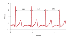 Heart Rate Variability Science for Sport