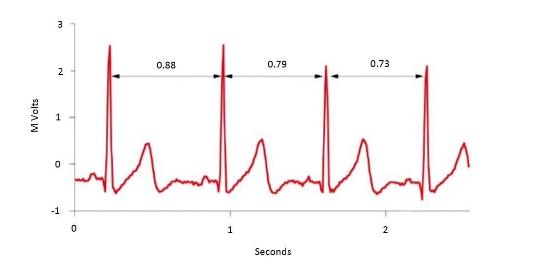 Heart Rate Variability HRV 