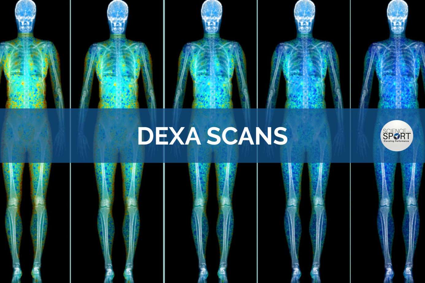Dualenergy Xray Absorptiometry (DEXA) Scans Science for Sport