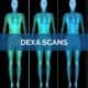 DEXA Scan - Science for Sport - Performance Testing