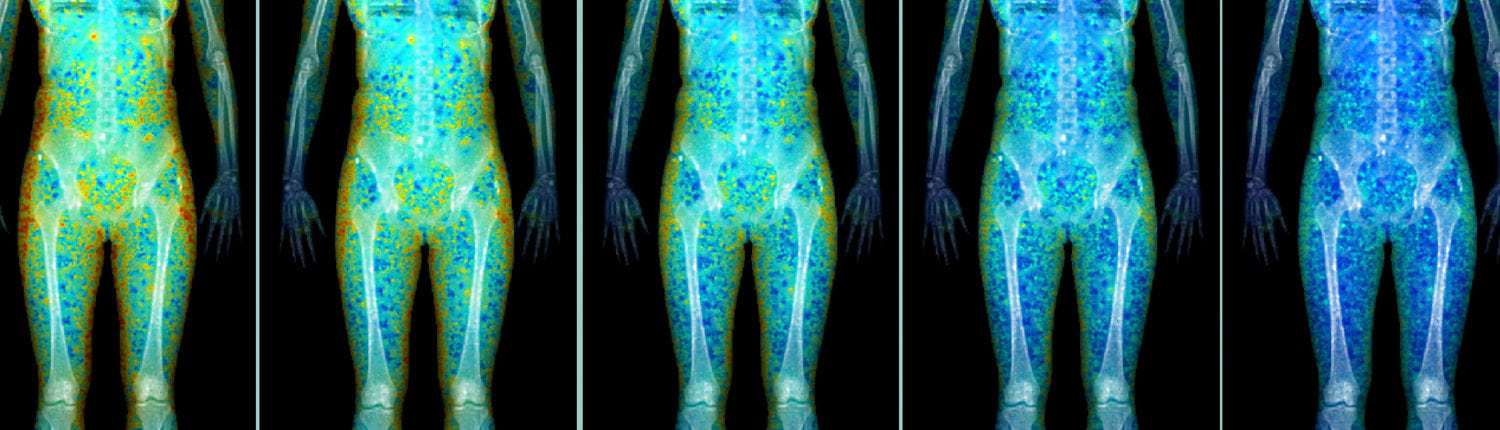 What are the best scans for imaging the body?